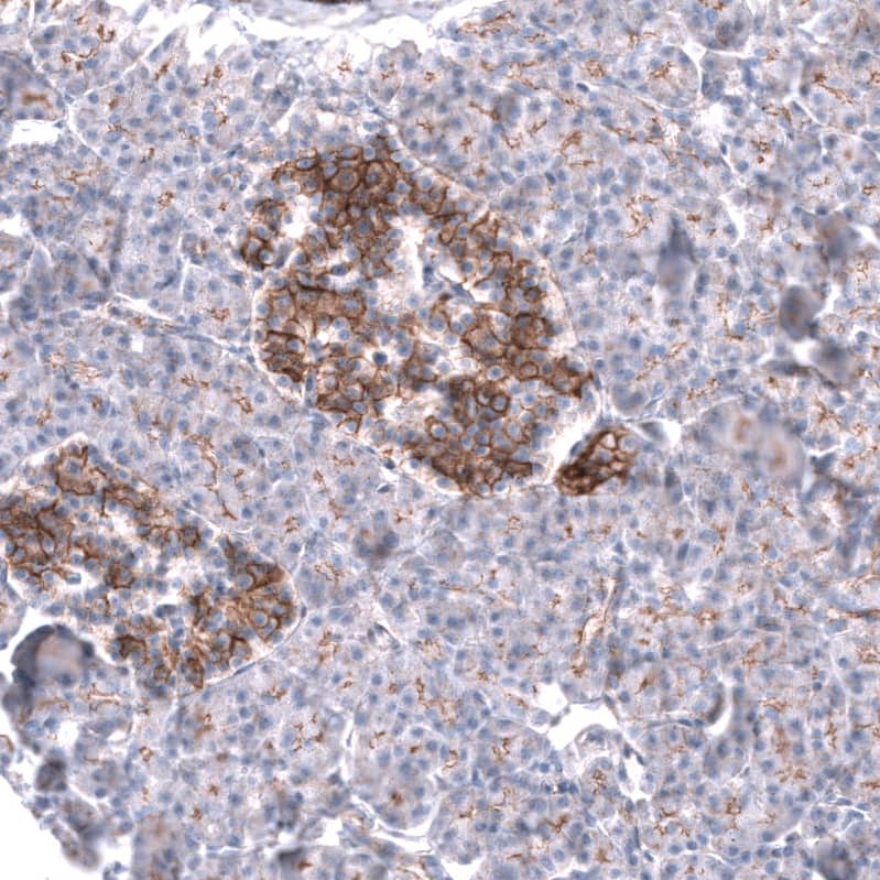 Staining of human pancreas shows moderate membranous positivity in the islets of Langerhans.