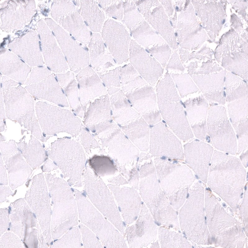 Staining of human skeletal muscle shows no positivity in myocytes as expected.