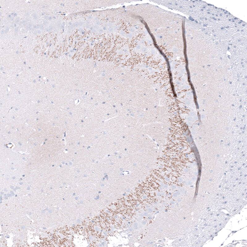 Staining of rat brain shows weak to moderate positivity in neuronal processes in the CA3 area of the hippocampus.