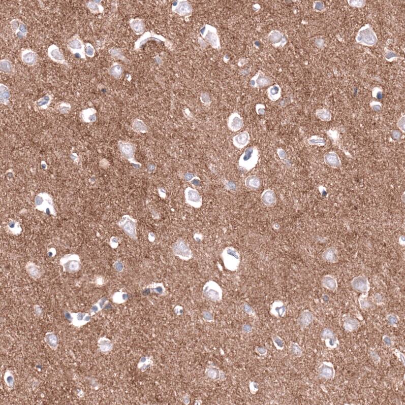 Staining of human cerebral cortex shows moderate to strong positivity in neuropil.