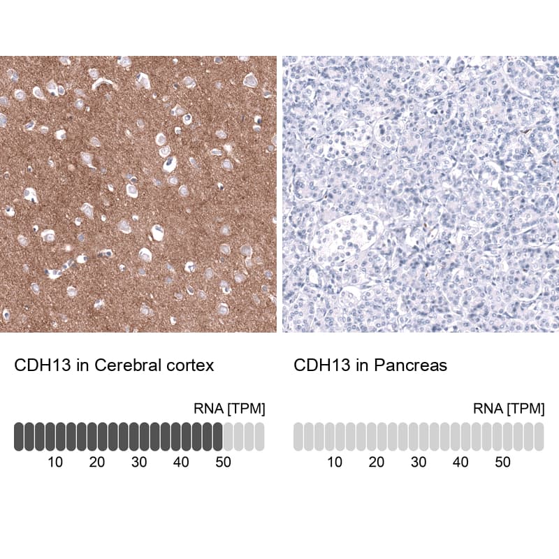 Analysis in human cerebral cortex and pancreas tissues using NBP3-43666 antibody. Corresponding CDH13 RNA-seq data are presented for the same tissues.