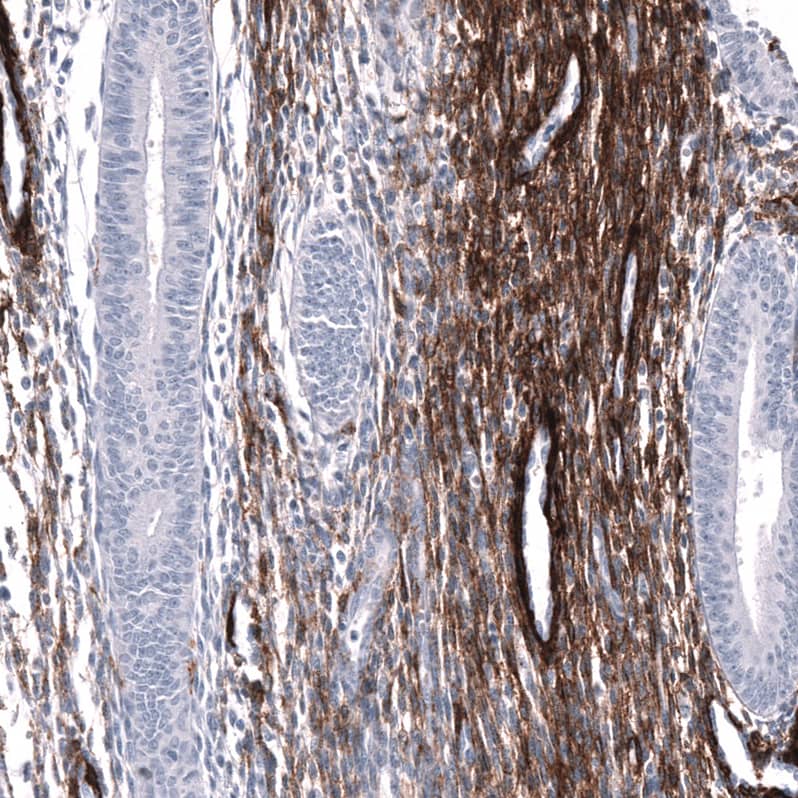 Staining of human endometrium shows strong membranous positivity in stromal cells.