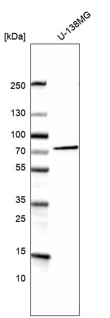 Analysis in human cell line U-138MG.