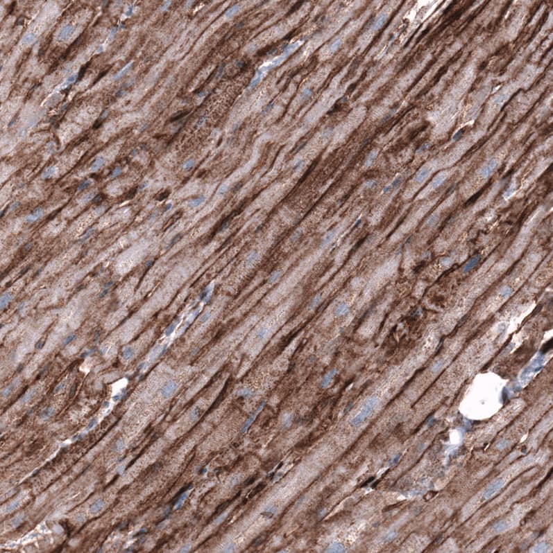 Staining of human heart muscle shows strong membranous positivity in cardiomyocytes.