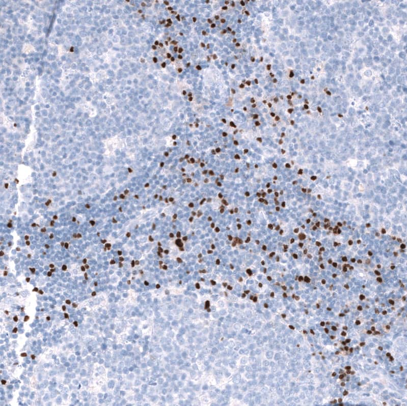 Staining of human tonsil shows strong nuclear positivity in non-germinal center cells.