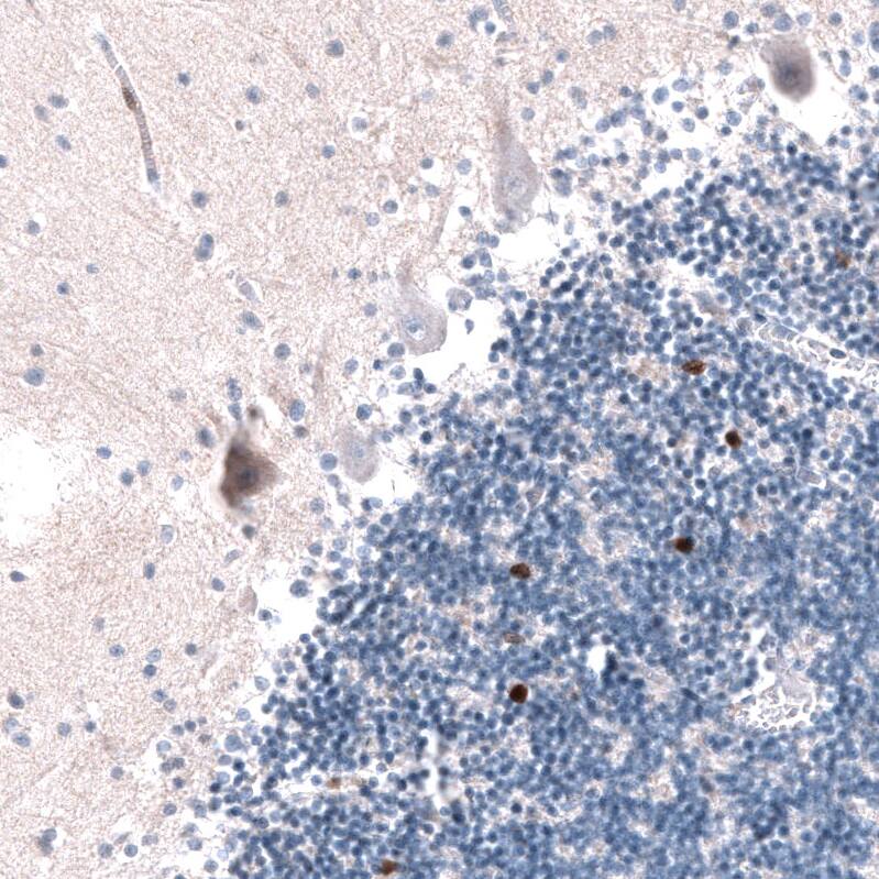 Staining of human cerebellum shows strong nuclear positivity in a subset of neurons in the granular layer.