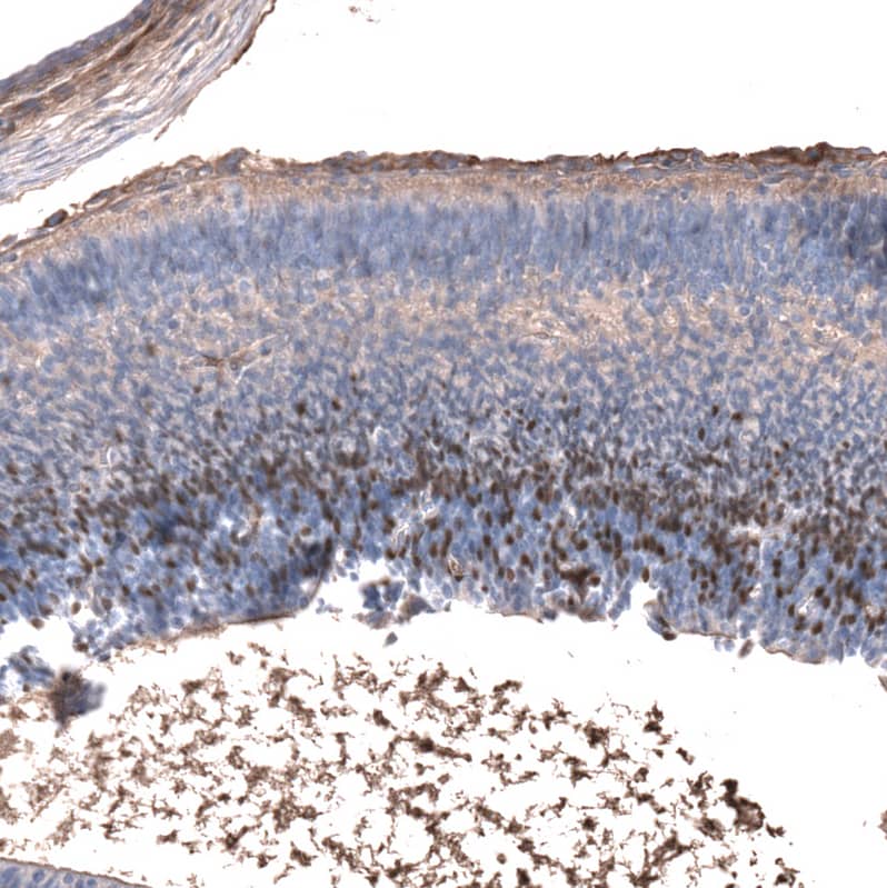 Staining of mouse embryo, E14 shows moderate to strong nuclear positivity in neuronal cells in the developing cortex.