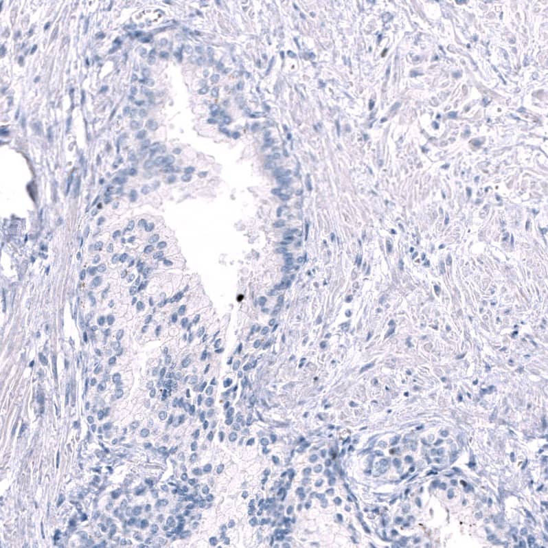 Staining of human prostate shows no positivity in glandular cells as expected.