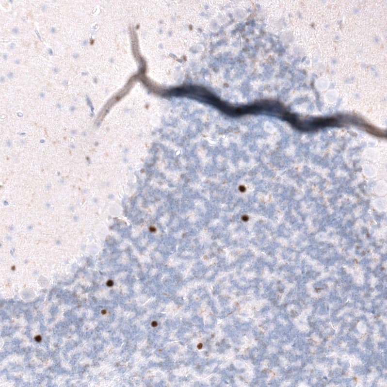 Staining of mouse brain shows moderate to strong nuclear positivity in a subset of neurons in the cerebellum.