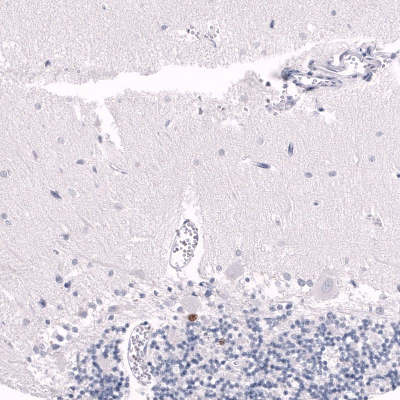 Staining of human cerebellum shows moderate to strong nuclear positivity in a subset of cells in granular layer.