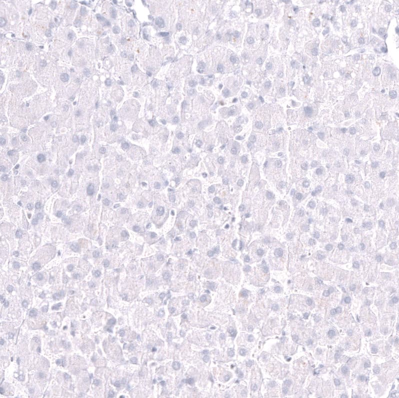 Staining of human liver shows no positivity in hepatocytes as expected.