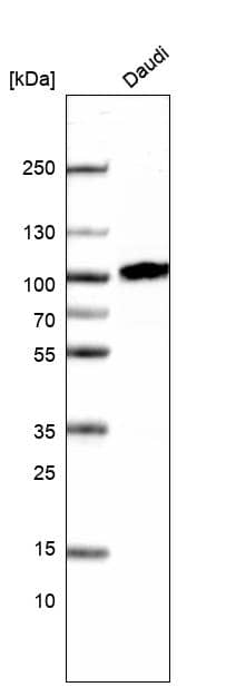 Analysis in human cell line Daudi.