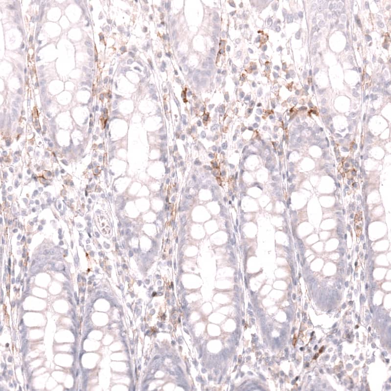 Staining of human rectum shows moderate membranous positivity in lymphoid cells.