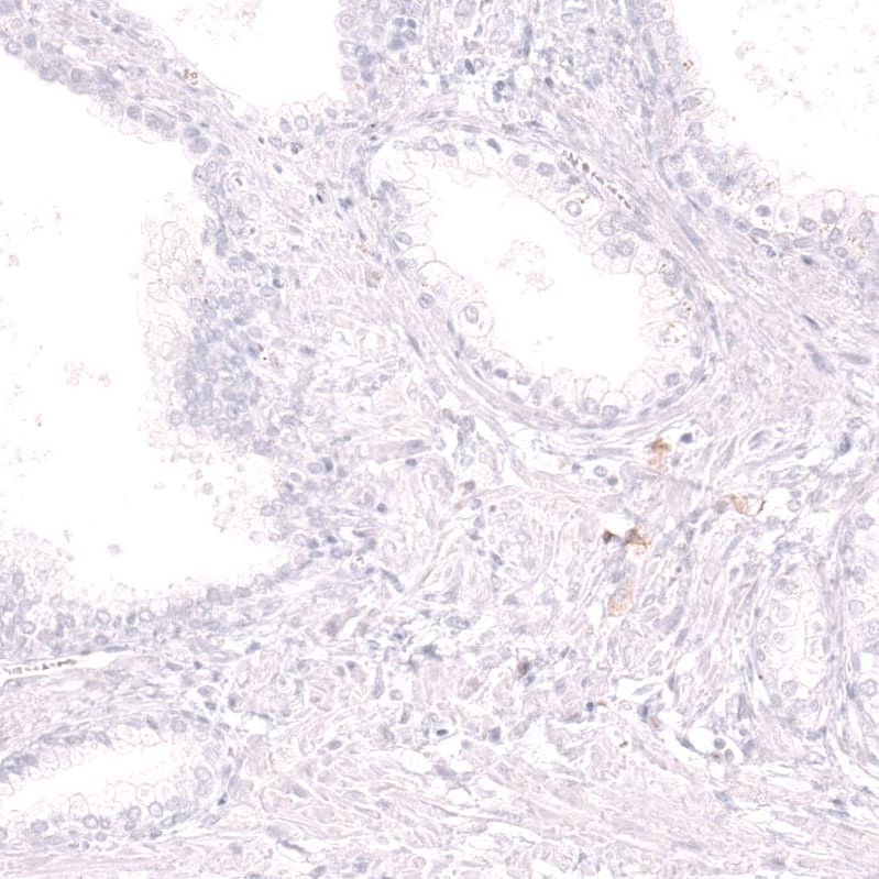 Staining of human prostate shows no positivity in glandular cells as expected.