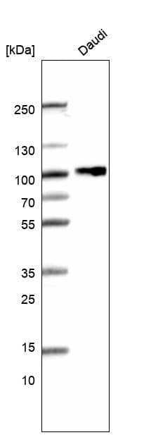 Analysis in human cell line Daudi.