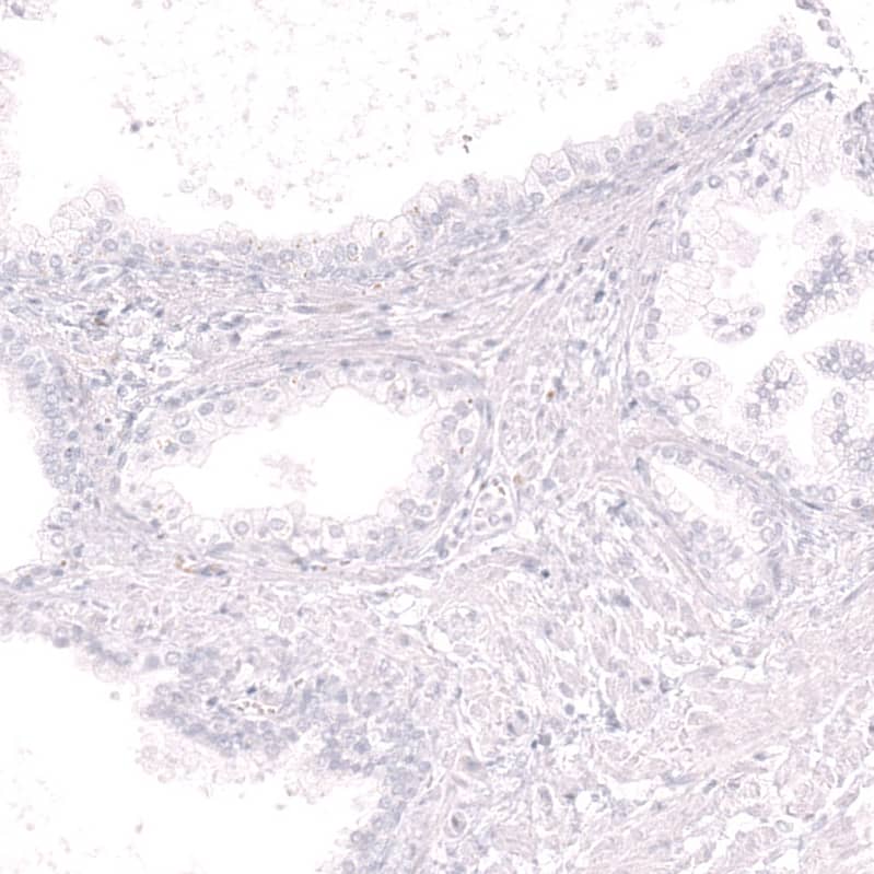 Staining of human prostate shows no positivity in glandular cells as expected.