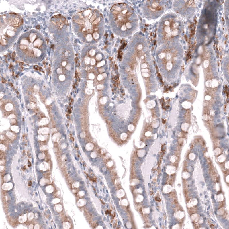 Staining of human duodenum shows strong membranous-cytoplasmic positivity in lymphoid cells and moderate cytoplasmic positivity in glandular cells.