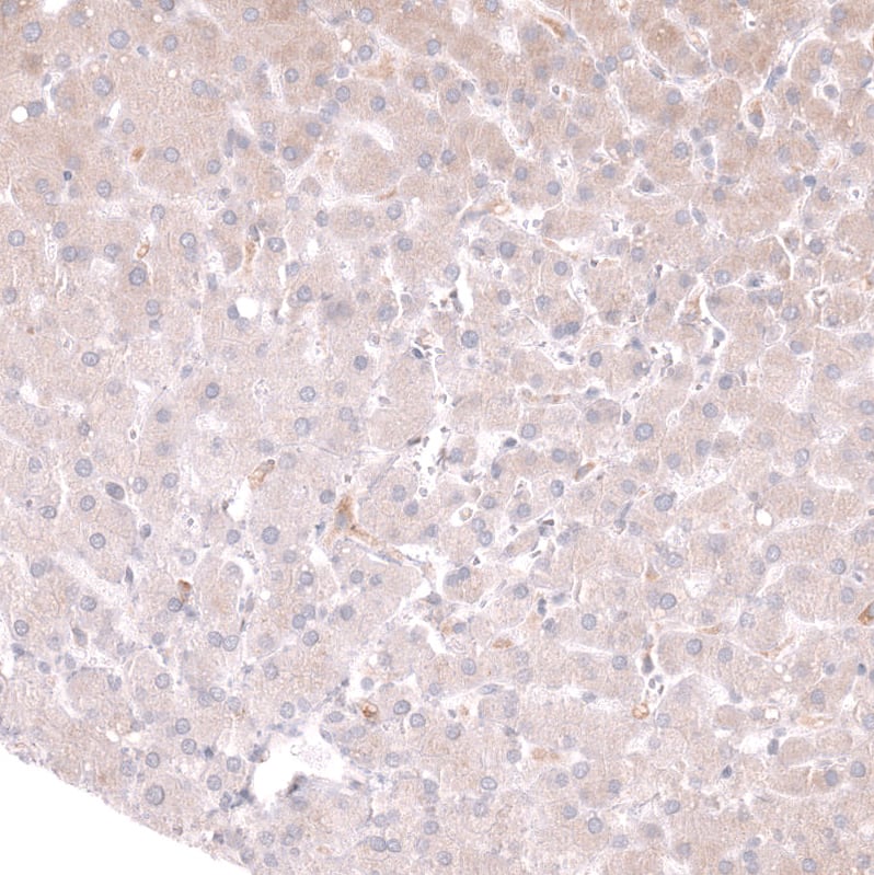 Staining of human liver shows very weak cytoplasmic positivity in hepatocytes.