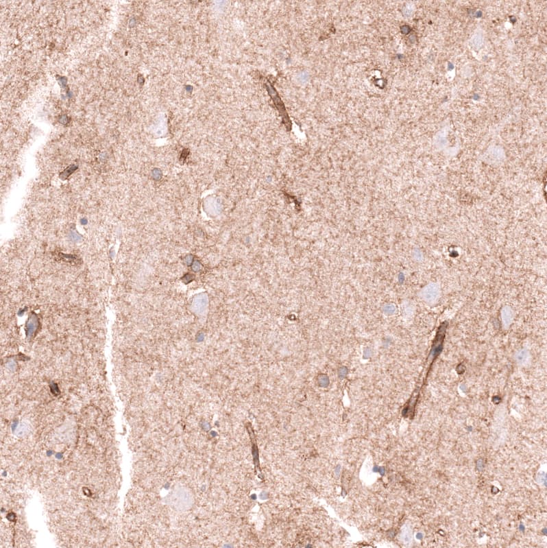 Staining of human cerebral cortex shows moderate membranous-cytoplasmic positivity in endothelial cells and neuropil.