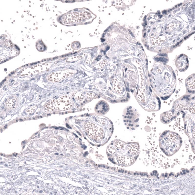 Staining of human placenta shows no positivity in trophoblastic cells as expected.