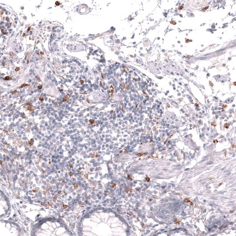 Staining of human rectum shows strong membranous-cytoplasmic positivity in lymphoid cells.