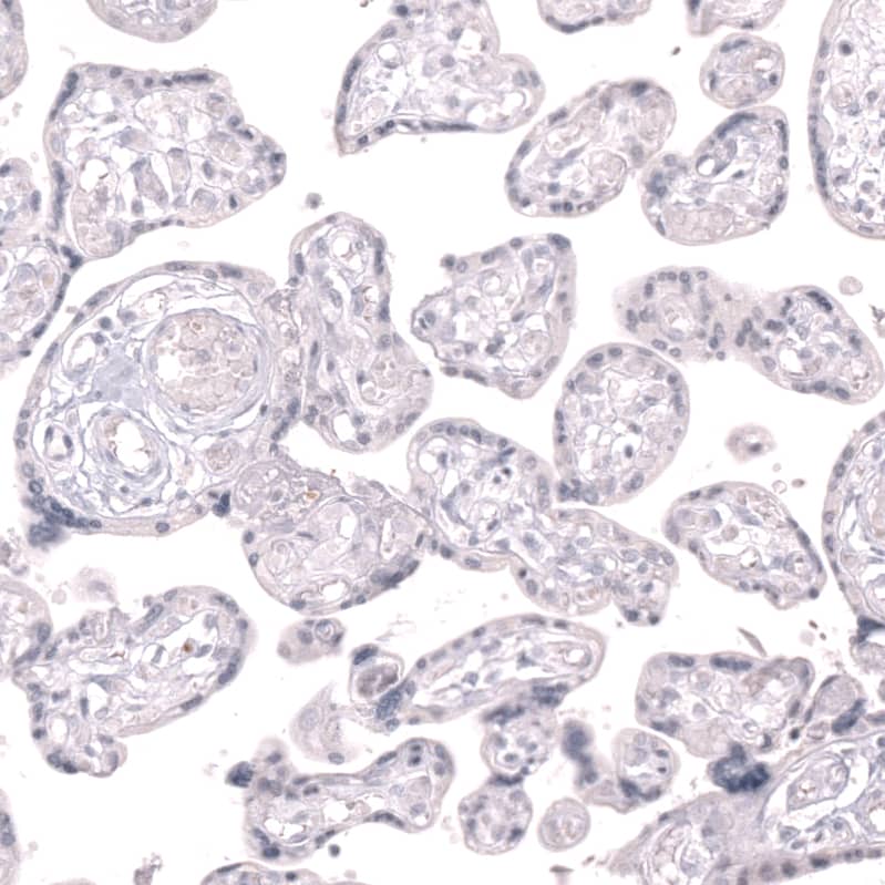 Staining of human placenta shows no positivity in trophoblastic cells as expected.