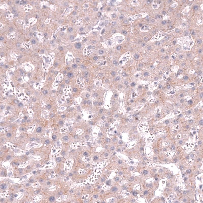 Staining of human liver shows moderate cytoplasmic and membranous positivity in hepatocytes.