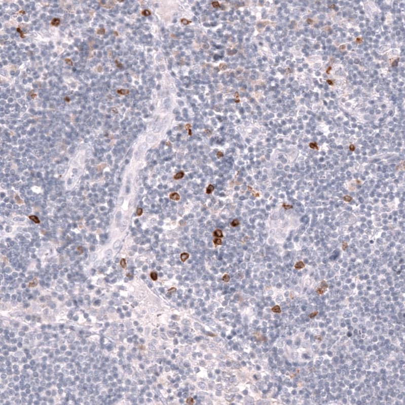 Staining of human lymph node shows strong membranous positivity in non-germinal center cells.