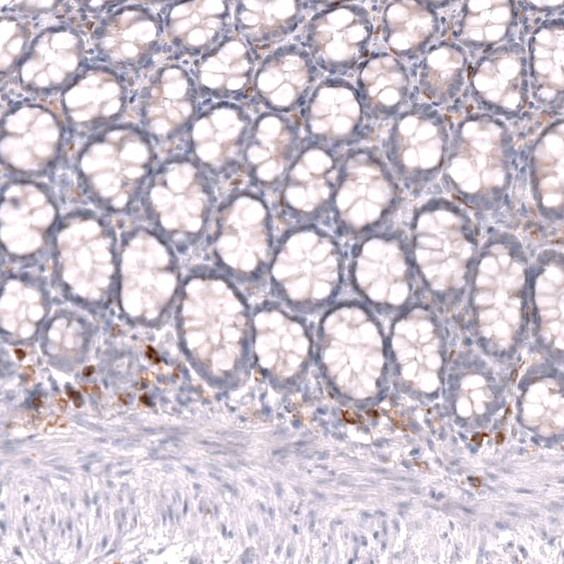 Staining of human colon shows strong membranous positivity in lymphoid cells.