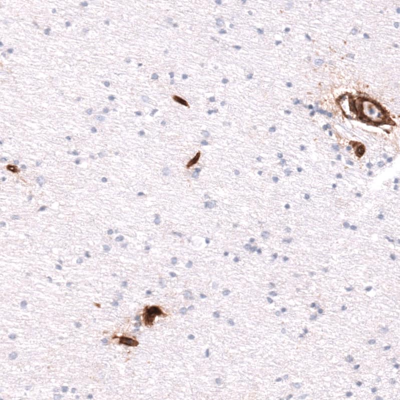 Staining of human cerebral cortex shows strong positivity in endothelial cells.