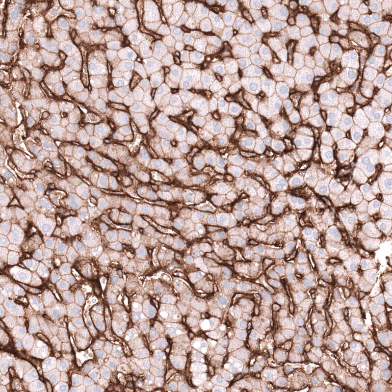 Staining of human liver shows strong positivity in sinusoids, as well as weaker membranous positivity in hepatocytes.