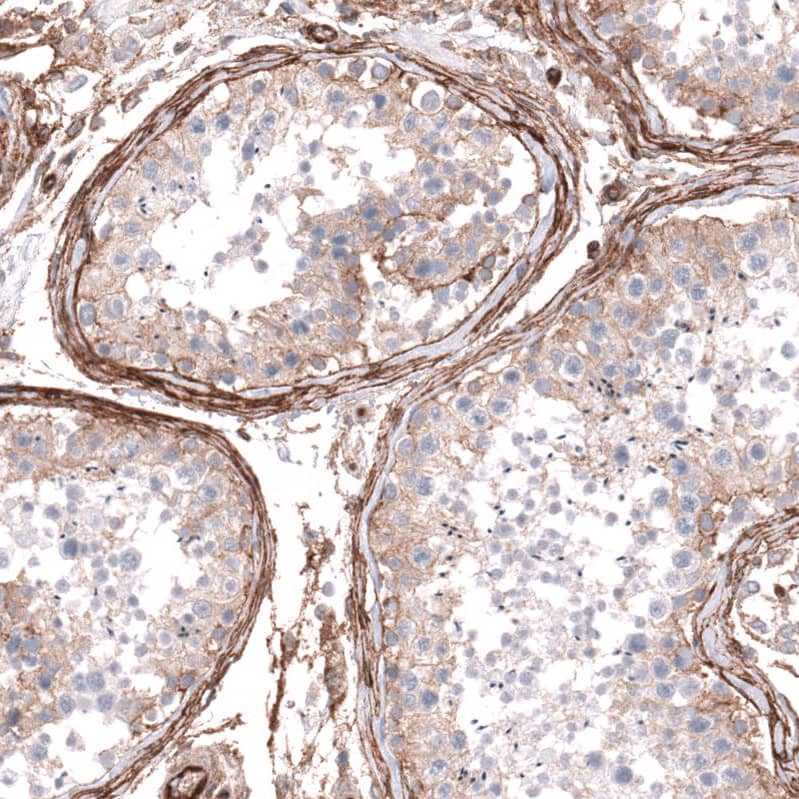 <b>Orthogonal Strategies Validation. </b>Staining of human testis shows strong membranous positivity in peritubular myoid cells.