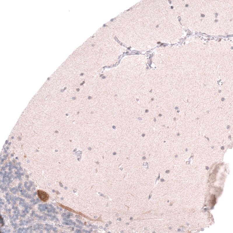 Staining of human cerebellum shows strong cytoplasmic positivity in Purkinje cell.