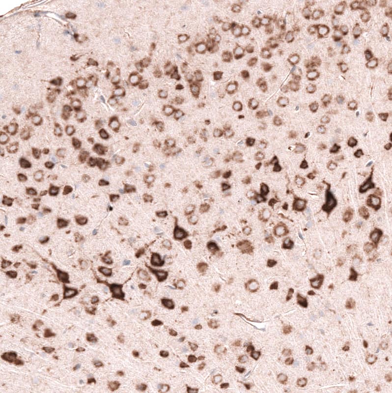 Staining of mouse cerebral cortex shows moderate to strong cytoplasmic positivity in neurons.