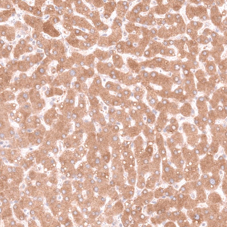 Staining of human liver shows moderate cytoplasmic positivity in hepatocytes.