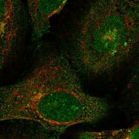 Staining of human cell line U-2 OS shows localization to nucleoplasm, cytosol & the Golgi apparatus.