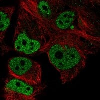 Immunocytochemistry/ Immunofluorescence COM1/p8 Antibody [Unconjugated] - BSA Free