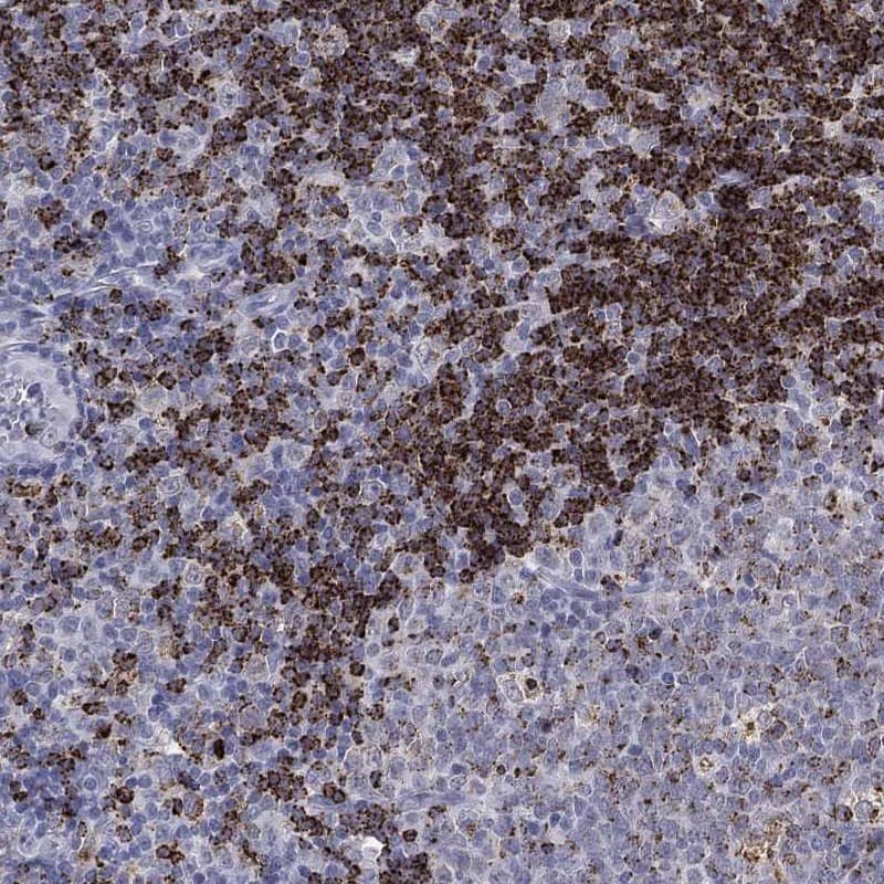 Immunohistochemistry-Paraffin HLA DOA Antibody [Unconjugated] - BSA Free