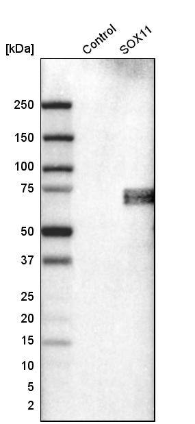 Analysis in control (vector only transfected HEK293T lysate) and sOX11 over-expression lysate (Co-expressed with a C-terminal myc-DDK tag (~3.1 kDa) in mammalian HEK293T cells) .