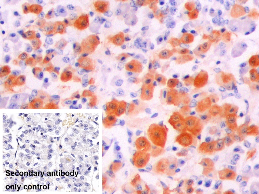 Immunohistochemistry-Paraffin: Alpha-Melanocyte Stimulating Hormone Antibody - BSA Free [NBP3-43691] - DAB staining of Porcine Pituitary Tissue. Primary Ab: 10µg/ml NBP3-43691. Second Ab: 2ug/ml HRP-conjugated Goat Anti-Rabbit IgG Polyclonal antibody. Control: Used PBS instead of primary antibody