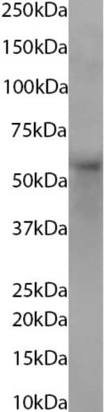 Western Blot: Glypican 1 Antibody (AbAb2-GPC1) - Chimeric - BSA Free [NBP3-45127] - Human skin tissue lysate (35 µg protein in RIPA buffer) was resolved via SDS-PAGE, and the subsequent blot was probed with the mouse version of this antibody, NBP3-45126, at 1 µg/ml before detection using an anti-mouse secondary antibody. A primary incubation of 1 hour was used, and proteins were detected by chemiluminescence.