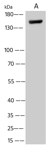 Western Blot: Nipah Virus Glycoprotein G Antibody [NBP3-43765] - NBP3-43765 at 1:500 dilution Lane A: HepG2 Whole Cell Lysate Lysates/proteins at 30 ug per lane. Secondary Goat Anti-Rabbit IgG (H+L)/HRP at 1/10000 dilution. Developed using the ECL technique. Performed under reducing conditions. Predicted band size:127 kDa 