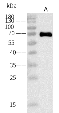 Western Blot: Rabies Virus Glycoprotein Antibody [NBP3-43766] - NBP3-43766 in 0.2 ug/mL. Lane A: Rabies virus (RABV) Glycoprotein/G Protein (10ng) Secondary Goat Anti-Rabit IgG (H+L) [HRP] at 1/10000 dilution Developed using the ECL technique. Performed under reducing conditions. 