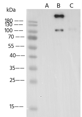 Western Blot: VZV Glycoprotein B Antibody - (Oka vaccine) [NBP3-43770] - NBP3-43770 in 0.2 ug/mL. Sample: Recombinant Protein 5 ng Lane A: VZV / HHV-3 gE / glycoprotein E Protein Lane B: VZV (strain Oka vaccine) Glycoprotein B Protein Lane C: VZV (strain Oka vaccine) gH & gL Heterodimer Protein Secondary Goat Anti-Rabit IgG (H+L) [HRP] at 1/10000 dilution Developed using the ECL technique. Performed under reducing conditions. 