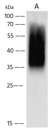 Western Blot Metapneumovirus Glycoprotein G Antibody - (HMPV/Homo sapiens/PER/CFI0466/2010/B) - Azide and BSA Free