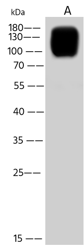 Western Blot: Vaccinia Virus A27L Antibody - (Copenhagen) [NBP3-43776] - NBP3-43776 at 1:500 dilution Lane A: Rat liver tissue lysate Lysates/proteins at 30 ug per lane. Secondary Goat Anti-Rabbit IgG (H+L)/HRP at 1/10000 dilution. Developed using the ECL technique. Performed under reducing conditions. Predicted band size: 57 kDa Observed band size: 100-180 kDa 