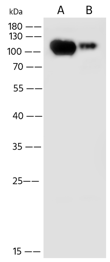 Western Blot: Vaccinia Virus B5 Antibody - (Copenhagen) [NBP3-43777] - NBP3-43777 at 1:500 dilution Lane A: SH-SY5Y Whole Cell Lysate Lane B: Daudi Whole Cell Lysate Lysates/proteins at 30 ug per lane. Secondary Goat Anti-Rabbit IgG (H+L)/HRP at 1/10000 dilution. Developed using the ECL technique. Performed under reducing conditions. Predicted band size:65 kDa Observed band size:115 kDa 