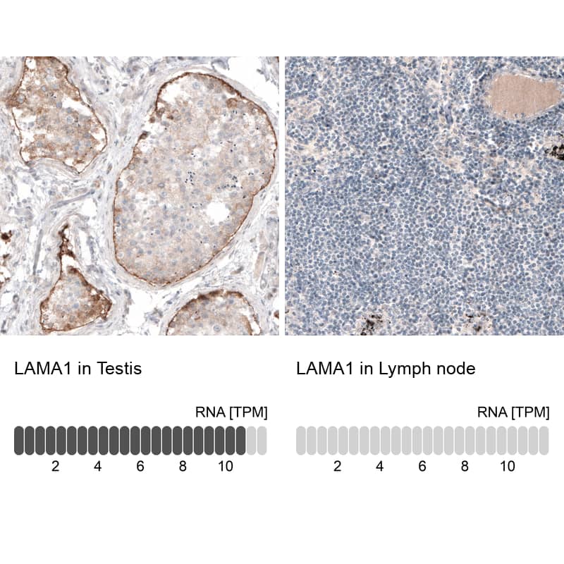 Analysis in human testis and lymph node tissues using NBP3-43782 antibody. Corresponding Laminin RNA-seq data are presented for the same tissues.