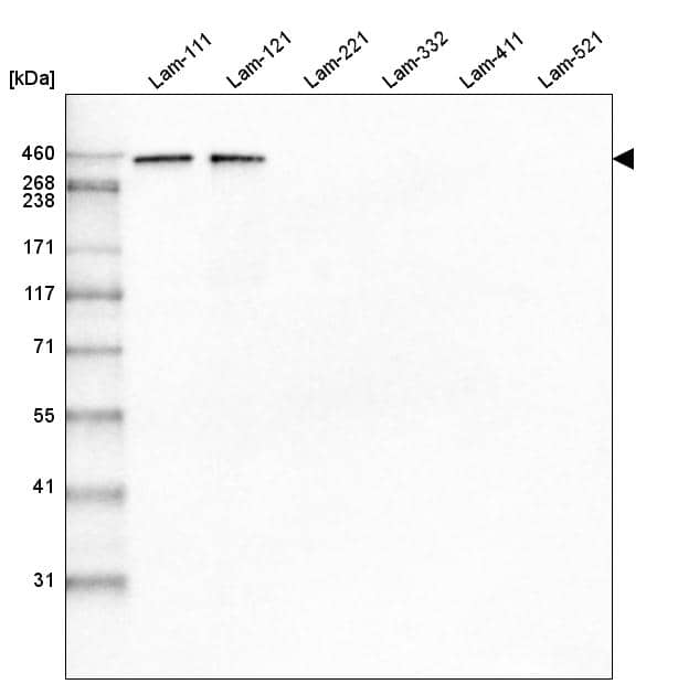Analysis of purified human recombinant Laminin-111, Laminin-121, Laminin-221, Laminin-332, Laminin-411 and Laminin-521.