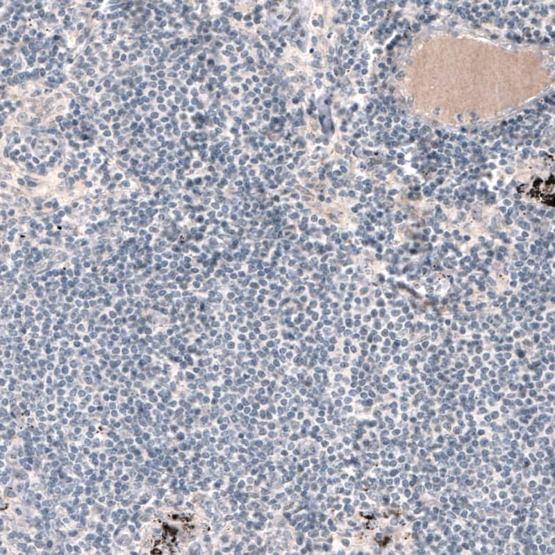 Staining of human lymph node shows no positivity in lymphoid cells as expected.